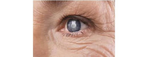 National-Glaucoma-Awareness-Month-2024